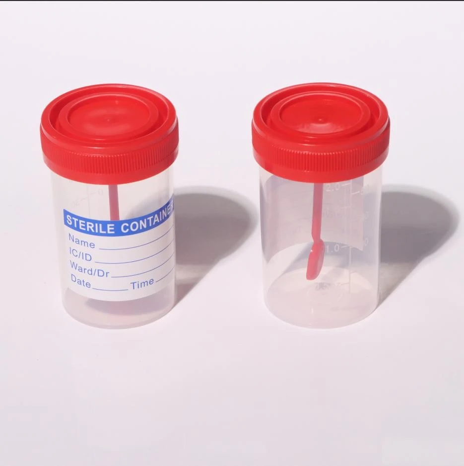 Urine Stool Specimen Container best